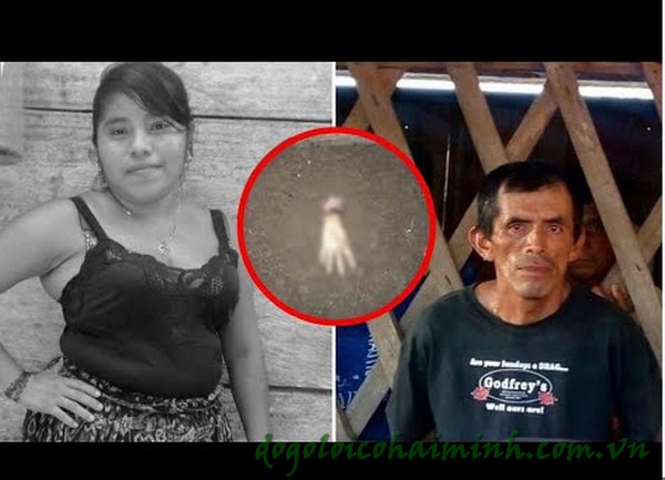 Las secuelas del ataque de Tuc Ical a Alejandra Ico con un cuchillo